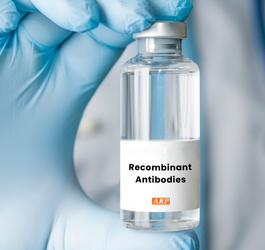 Monoclonal, Polyclonal & Recombinant Antibodies: How they differ and how they are made
